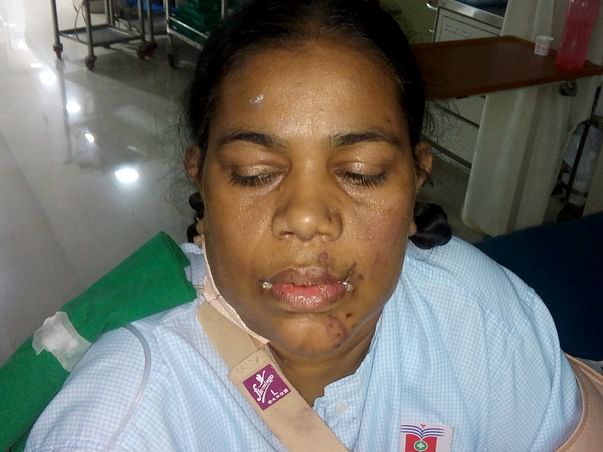 Help My Mother Who Met With A Train Accident