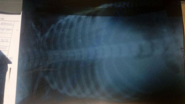 xray reports