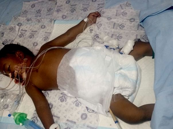 Help V.Rohith Suffering With Dengue Shock Syndrome, Lung Damaged, ARDS