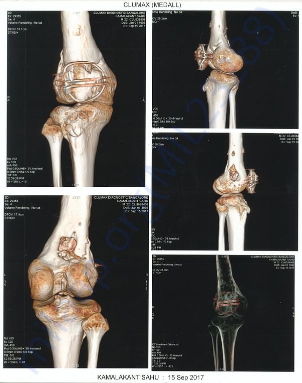 xrays