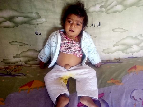 He Needs An Urgent Liver Transplant To Stay Alive For His 1st Birthday