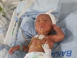 Save Baby Mokshith Who Was Born At 5 Months