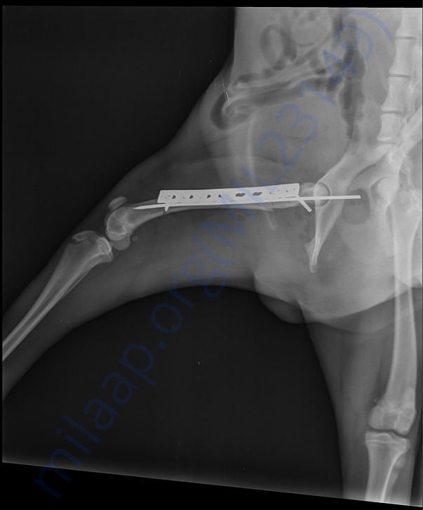 X ray After 1st surgery