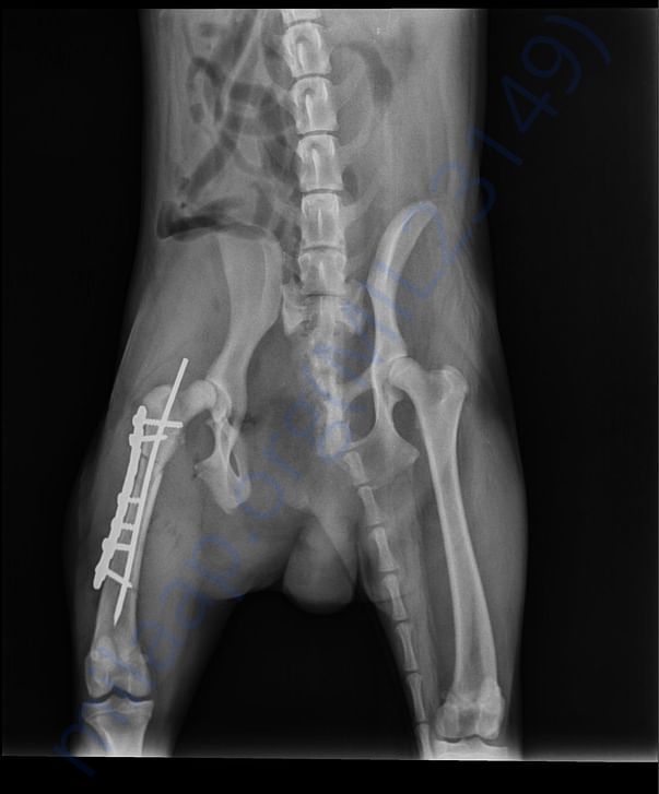 X ray After first surgery