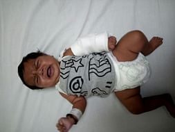 My 3-month-old Daughter Turns Blue Because of A Heart Defect