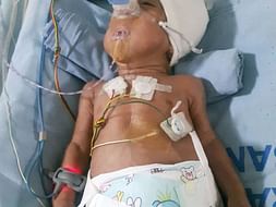 Save mokshith premature baby