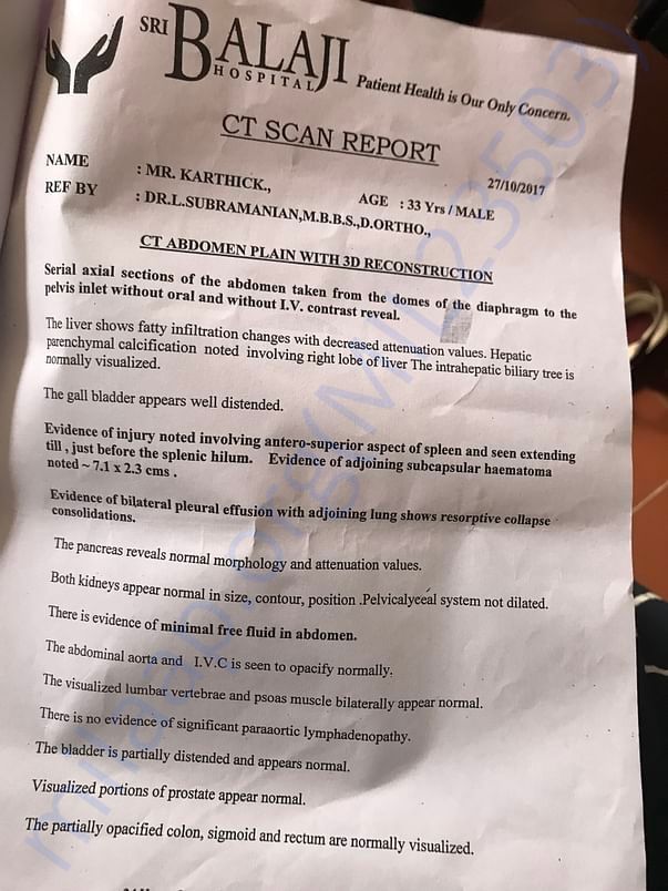 CT SCAN