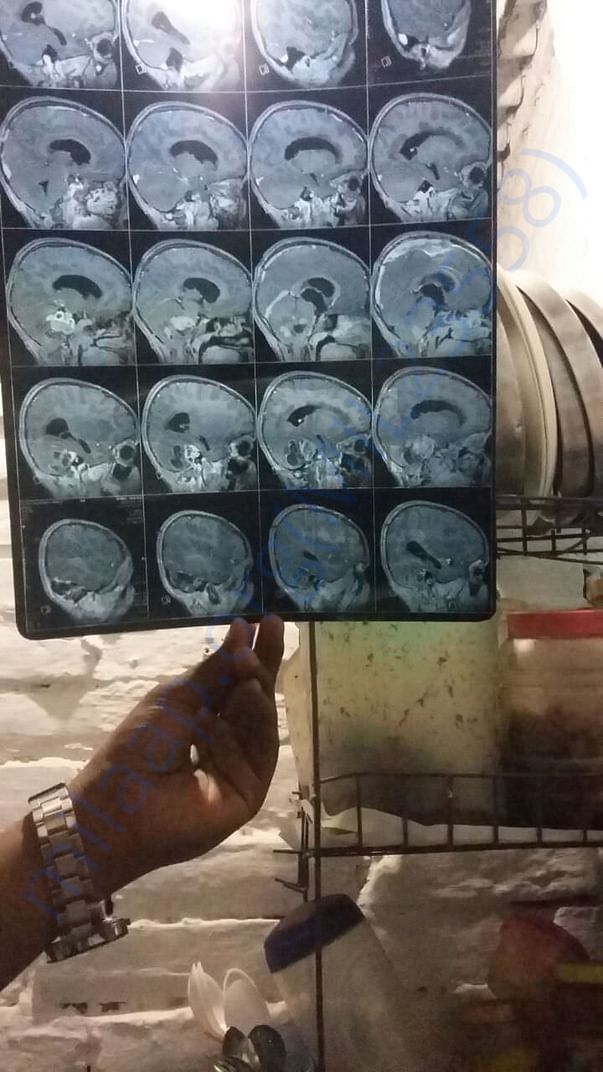 CT Scan
