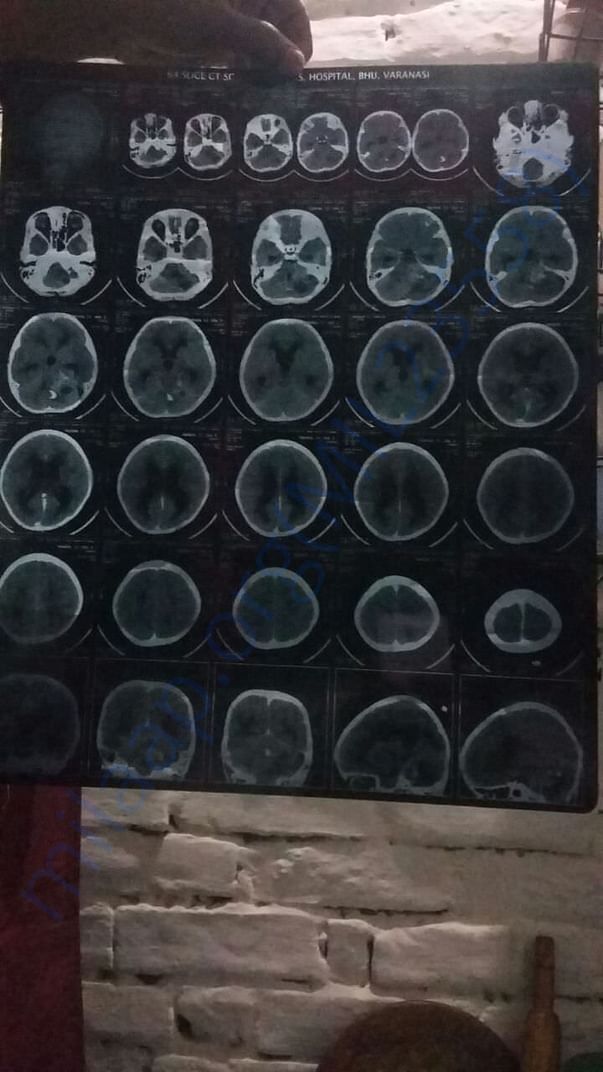 CT scan