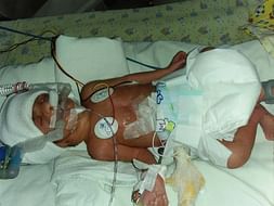 Help Tulasi’s Premature Baby Girl