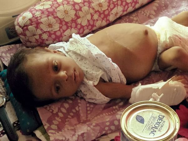 Help 6-Month Samriddho Fight A Severe Liver Disease & Bloated Stomach