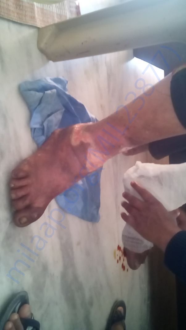 pictures of first aid treatment