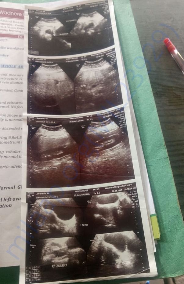 Sonography Images
