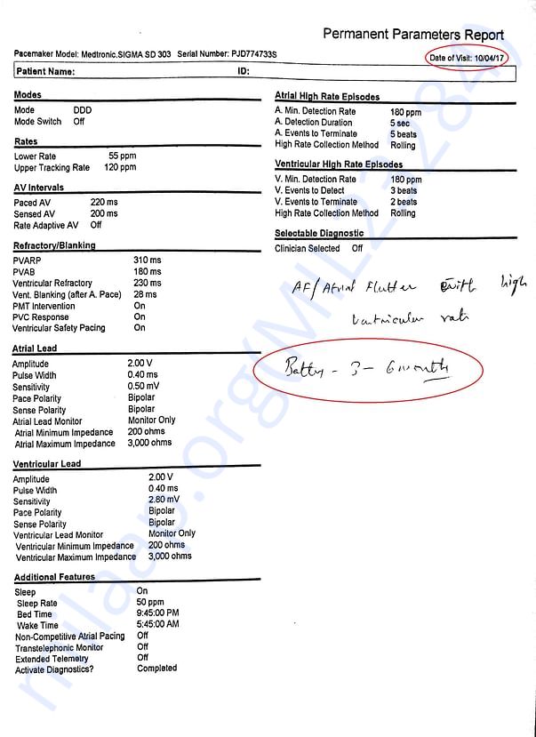 Recent implanted PaceMaker's Details -1