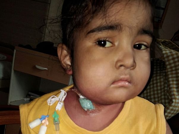 Please Help Us In Saving 4 Year Old Baby Gayathri