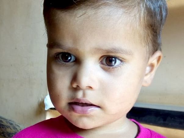 help baby payal solunke a heart patient