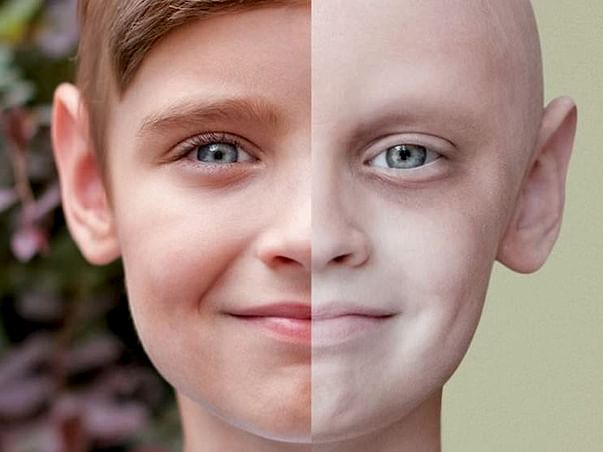 Help us raise money 4 awareness towards #HairDonation4CancerSurvivors