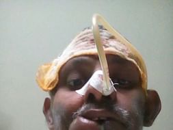 Help Venkat Fight Mouth Cancer