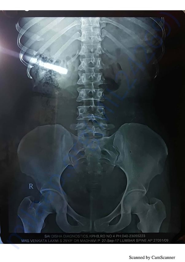 x-ray