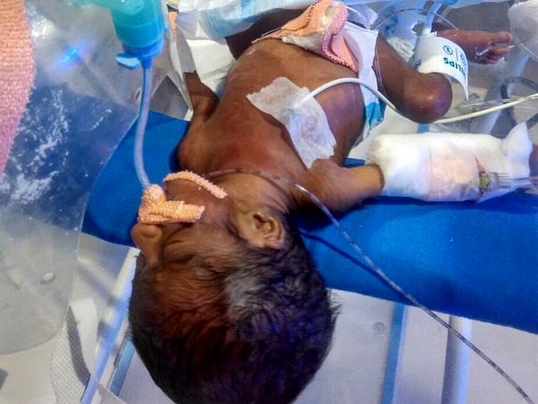 Please Help Newborn Baby in Critical Condition In Hyderabad