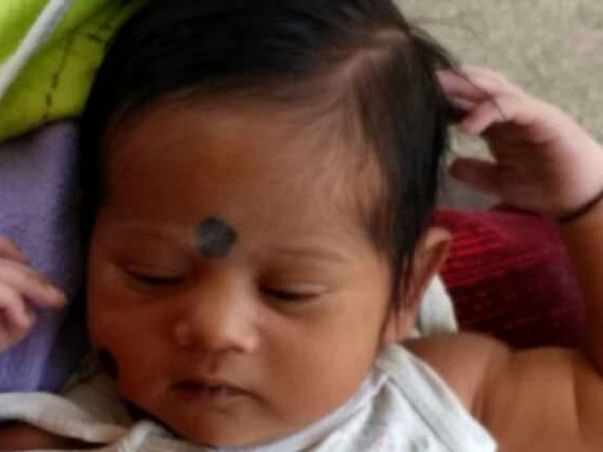 One Month Old Baby Needs Your Support For A Heart surgery