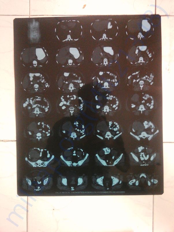 Ct scan xray
