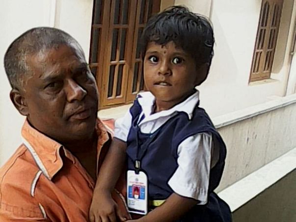 45% Of This Little Girls Body Is Burnt, She Needs Our Help