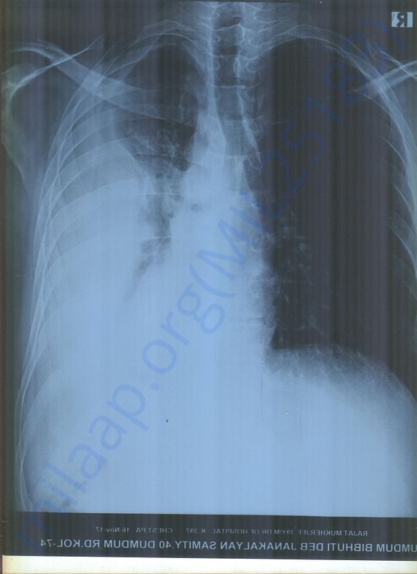 Xray