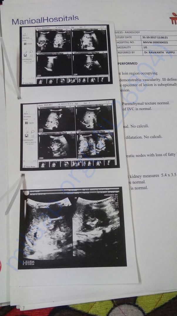 Abdomen Scan