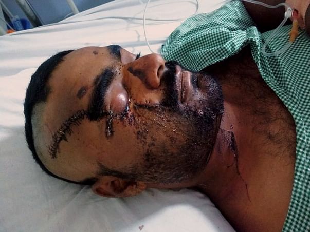 Help My Friend Undergo MaxilloFacial surgery and Rightleg operation