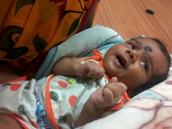 Help 2-month-old baby who was born with his bladder outside his body