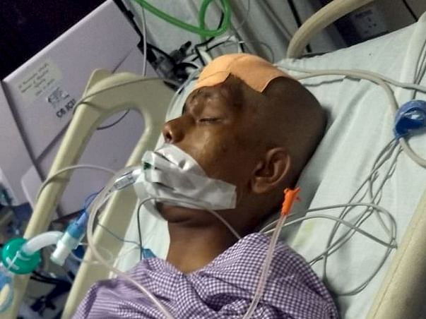 Head injured - complicated operation in head