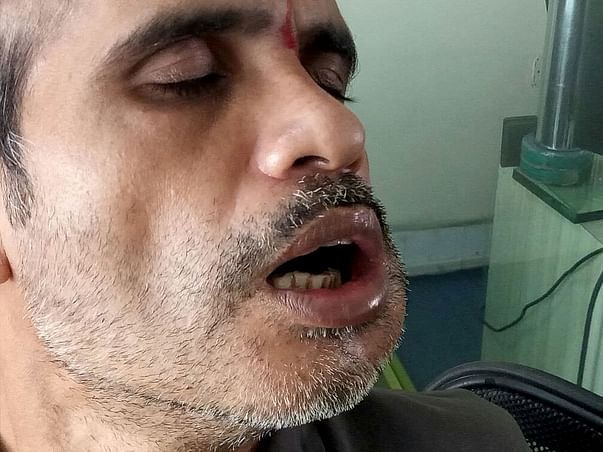 Help Vikas Fight Against Cancer