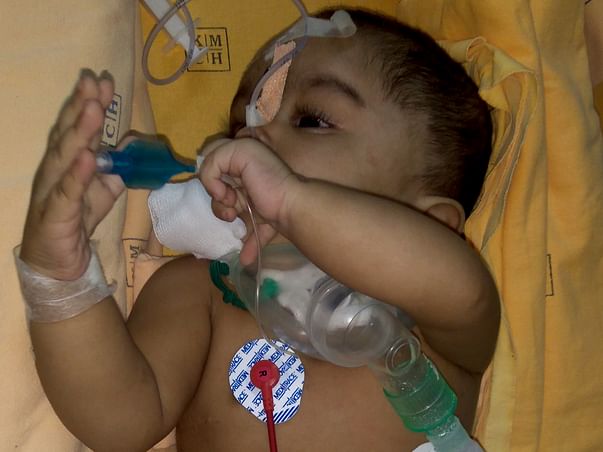 Help 9 Month Old Baby Danasri Fight Against Tracheostomy