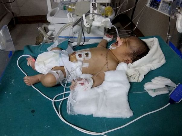 Save Aryan: Suffering from TGA Needs Severe Heart Surgery (8 days old)