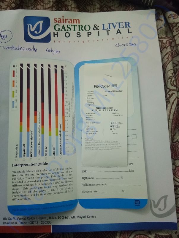 Fibto scan report