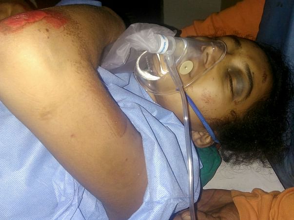 Help A Teenager Anusha Survive An Accident
