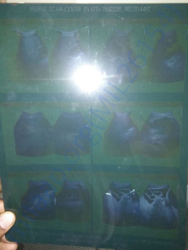 liver X Ray