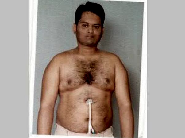 Help Mahaboob fight cancer