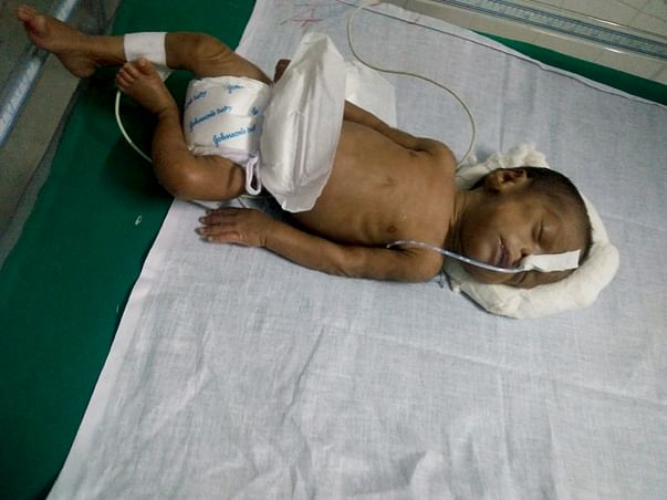 Help Baby suba fighting for life