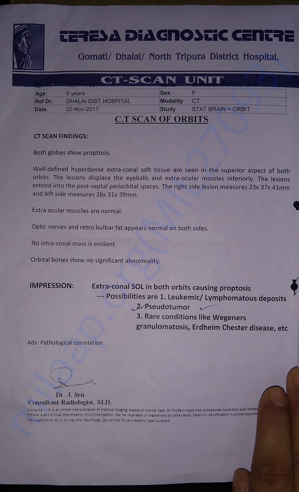 CT scan report