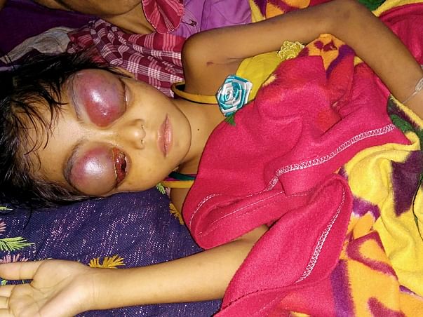 Help Dhanika To Fight Against Leukemia