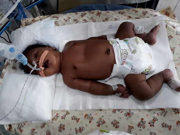 Sujatha's 1-month-old baby is suffering from Pneumonia and needs help