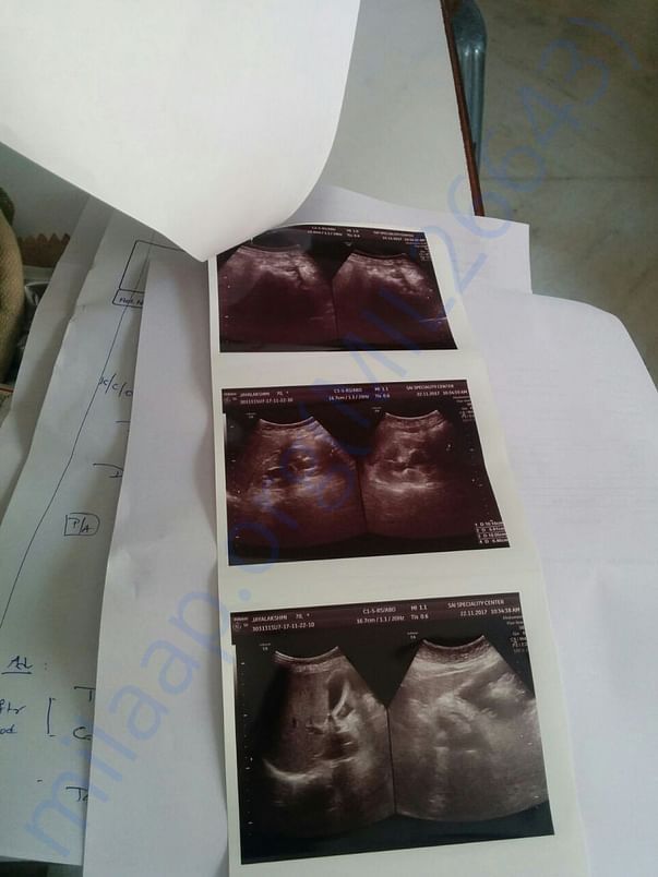 Sonography report - Abdomen & Pelvis - 24 Nov 17