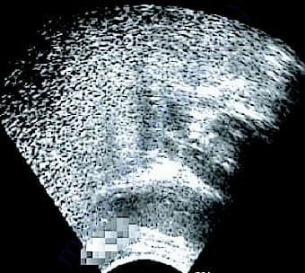 Scanning report