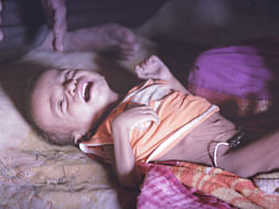 Help Melghat Childrens Fight Malnutrition
