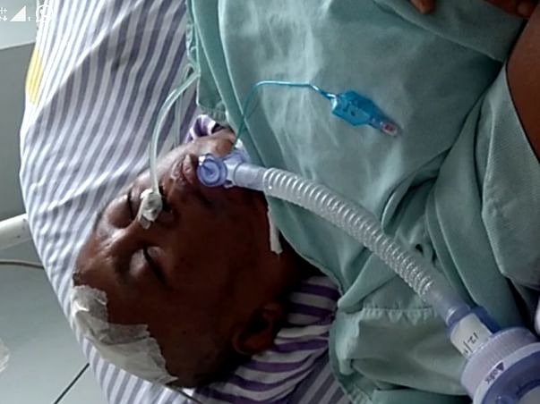Help to Survive Aneurysm