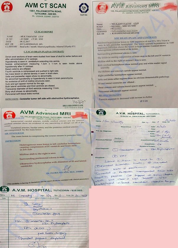 MRI, CT Scan report and Doctors recommendation