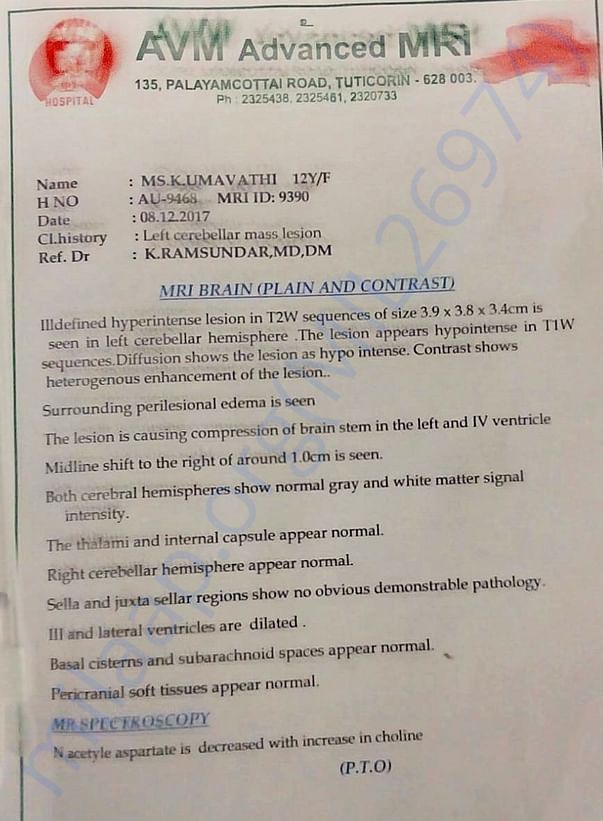 MRI SCAN REPORT