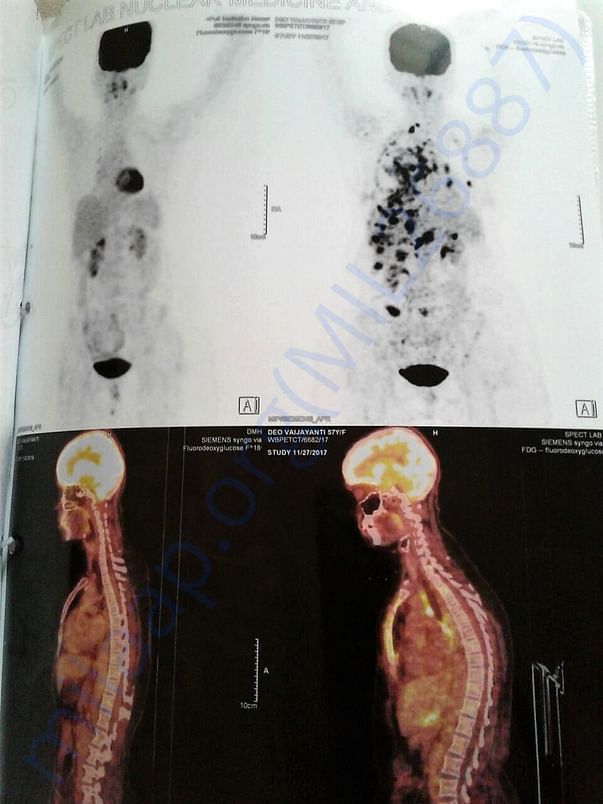Pet Scan Report - 3